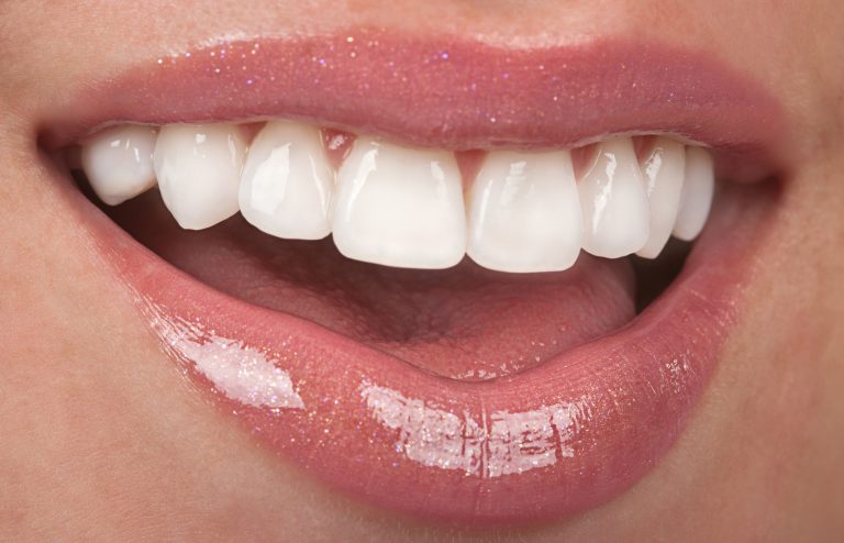 COSMETIC DENTISTRY IN MEDELLIN