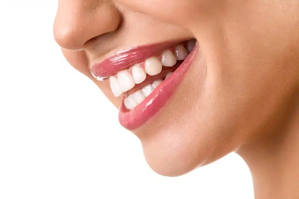 Cosmetic Dentistry in Medellin
