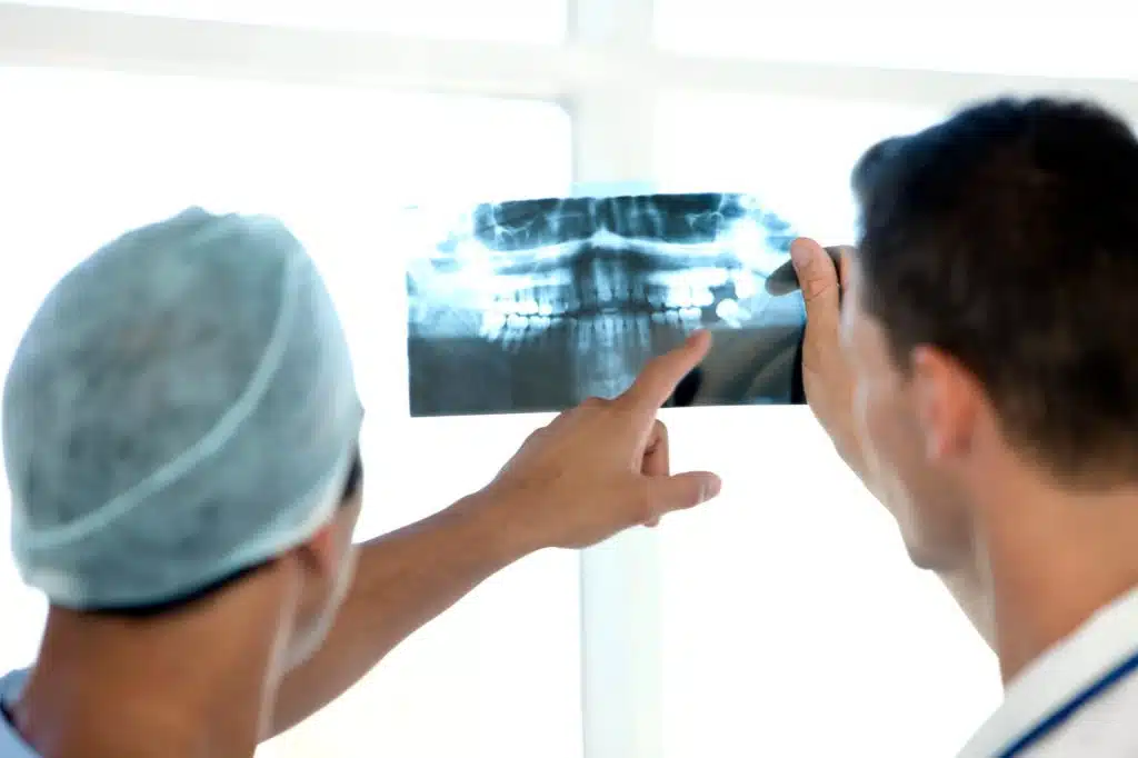 Root Canals Treatment Medellin